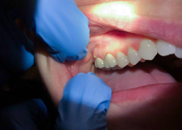 Best Pediatric Emergency Dentist in Center Moriches, NY